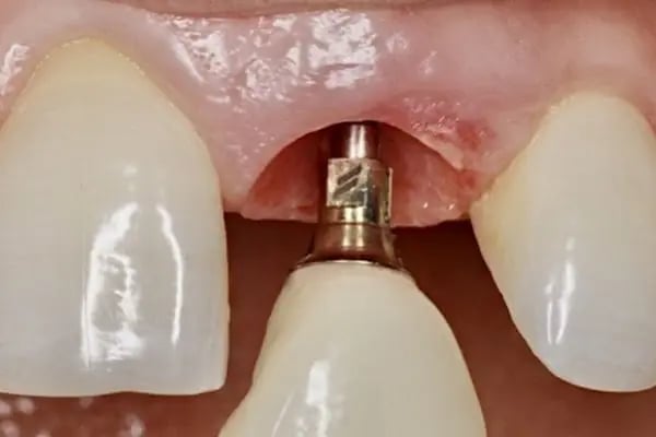 DigitalDent Ağız ve Diş Sağlığı Polikliniği - Resim 4