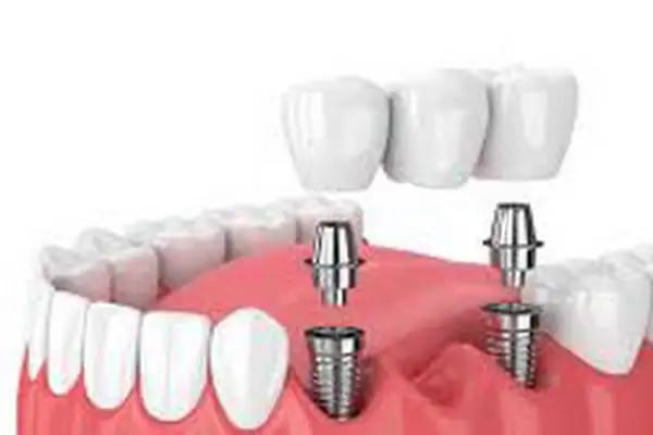 Dental Clinic Turkey - Resim 8