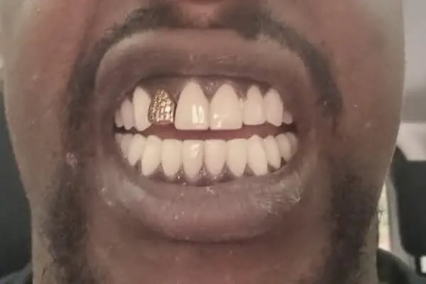 Dental Clinic Turkey - Resim 14