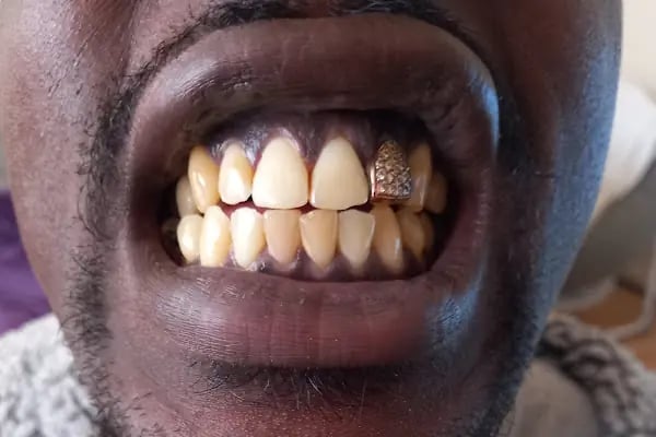 Dental Clinic Turkey - Resim 10