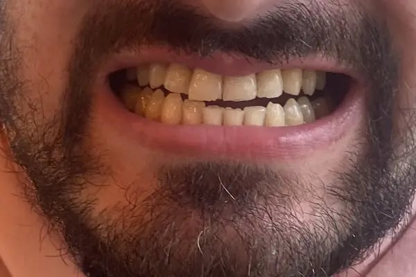 Dental Clinic Turkey - Resim 3
