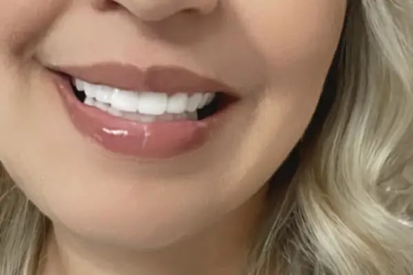 Dental Clinic Turkey - Resim 19