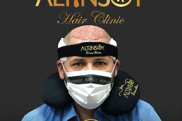 Erzurum Saç Ekim Merkezi Saç PRP`si | Altınsoy Hair Clinic - Resim 11