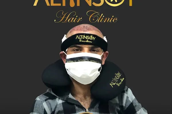 Erzurum Saç Ekim Merkezi Saç PRP`si | Altınsoy Hair Clinic - Resim 17