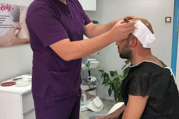 Erzurum Saç Ekim Merkezi Saç PRP`si | Altınsoy Hair Clinic - Resim 5