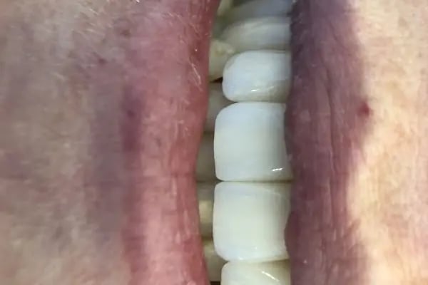 Swissdent Bodrum Diş Polikliniği &amp; Dental Clinic - Resim 20