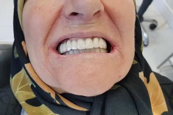 Swissdent Bodrum Diş Polikliniği &amp; Dental Clinic - Resim 19