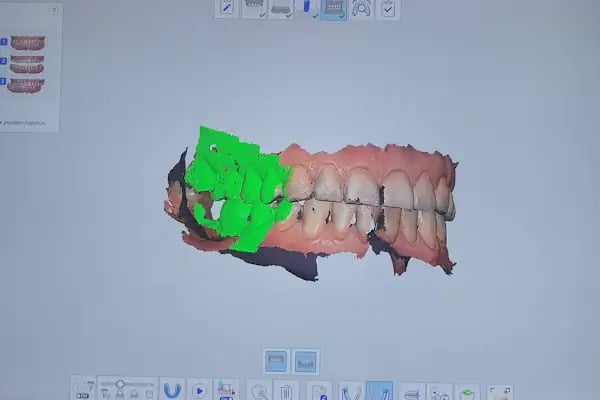 Swissdent Bodrum Diş Polikliniği &amp; Dental Clinic - Resim 12