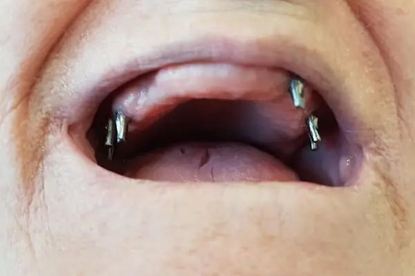 Swissdent Bodrum Diş Polikliniği &amp; Dental Clinic - Resim 13