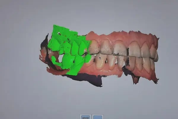 Swissdent Bodrum Diş Polikliniği &amp; Dental Clinic - Resim 4