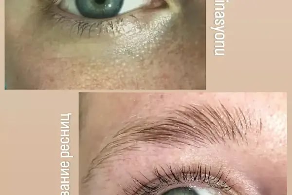 Butterfly Effect BEAUTY CENTER - Resim 14