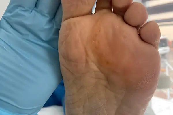 PODOZEY AYAK BAKIM MERKEZİ ALANYA - Resim 20