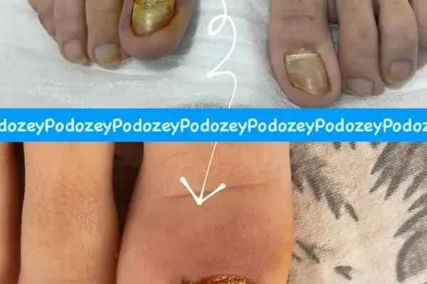 PODOZEY AYAK BAKIM MERKEZİ ALANYA - Resim 10