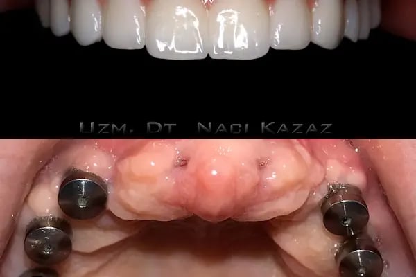 Özel Dentconcept Ağız ve Diş Sağlığı Polikliniği - Resim 20