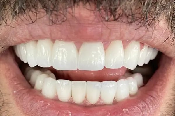 Diş Hekimi Muammer Küçük 7/24 Açık Diş Kliniği - Resim 15