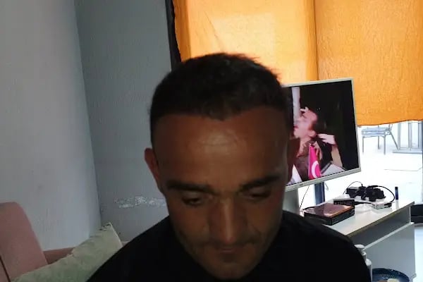 DR. BABACAN Medikal Estetik Saç Ekim&amp;Lazer Epilasyon&amp;Zayıflama - Resim 19