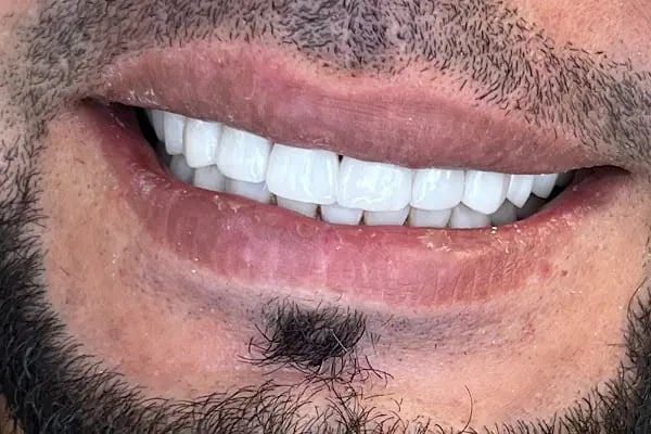 Özel LORAN Ağız ve Diş sağlığı polikliniği - Resim 6