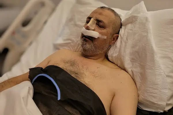 estethica Ataşehir | Saç Ekimi ve Plastik Cerrahi Hastanesi - Resim 20