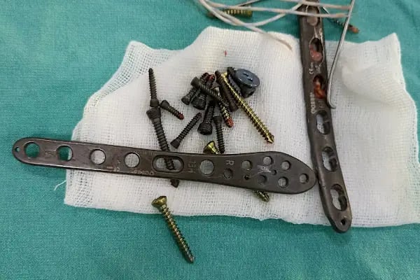 Op. Dr. Sercan Karadeniz, Ortopedi Ve Travmatoloji - Resim 4
