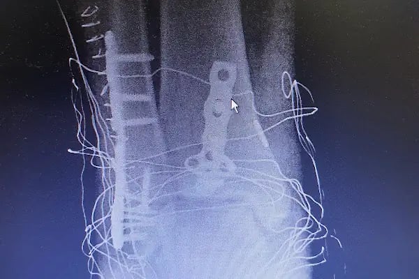 Op. Dr. Sercan Karadeniz, Ortopedi Ve Travmatoloji - Resim 2