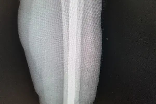 Op. Dr. Sercan Karadeniz, Ortopedi Ve Travmatoloji - Resim 17