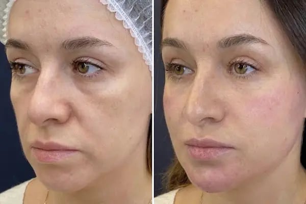 Op. Dr. Meltem Kılıç | İzmir Plastik, Rekonstrüktif ve Estetik Cerrahi | Aesthetics İzmir - Resim 8