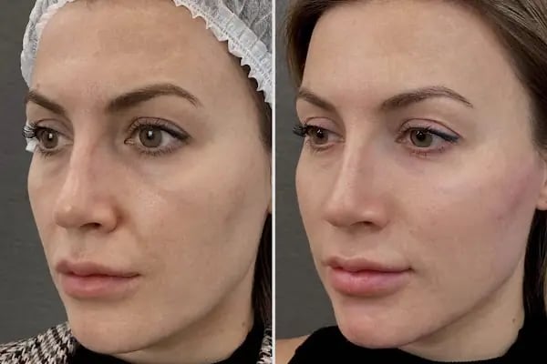 Op. Dr. Meltem Kılıç | İzmir Plastik, Rekonstrüktif ve Estetik Cerrahi | Aesthetics İzmir - Resim 6