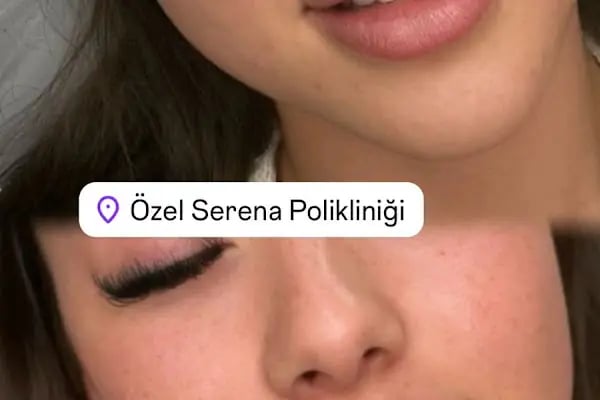 Op. Dr. Meltem Kılıç | İzmir Plastik, Rekonstrüktif ve Estetik Cerrahi | Aesthetics İzmir - Resim 3