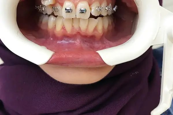 Özel Elit Ağız ve Diş Sağlığı Polikliniği - Resim 2