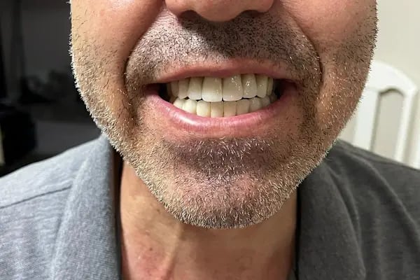 Özel Eftal Ağız ve Diş Sağlığı Polikliniği - Resim 14