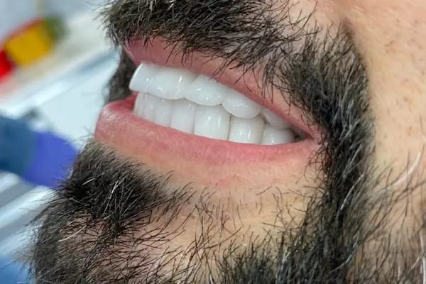 Özel Eftal Ağız ve Diş Sağlığı Polikliniği - Resim 7