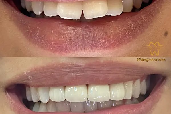 Özlüce Dent Palace Ağız ve Diş Sağlığı Polikliniği - Resim 12