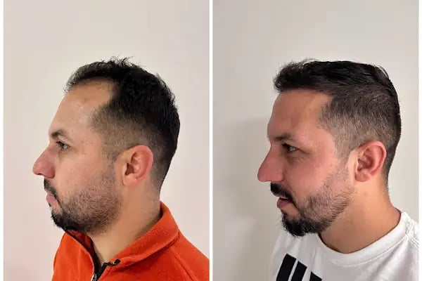 Ejem hair clinic- Saç Ekim merkezi - Resim 6