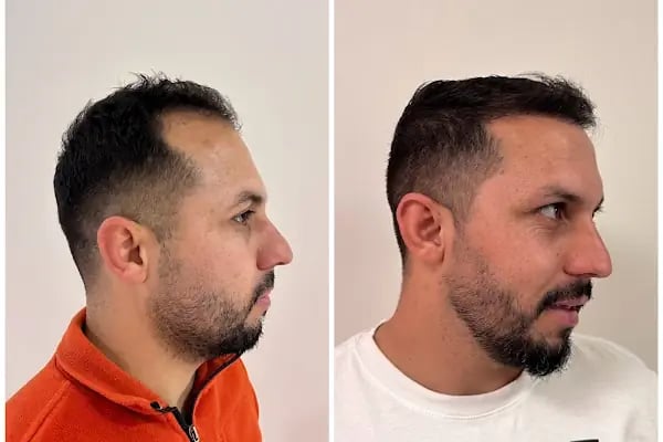 Ejem hair clinic- Saç Ekim merkezi - Resim 14
