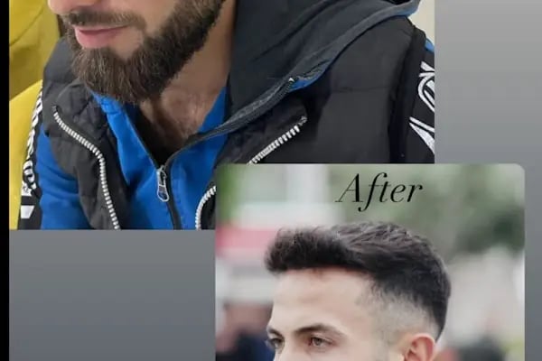 Ejem hair clinic- Saç Ekim merkezi - Resim 4