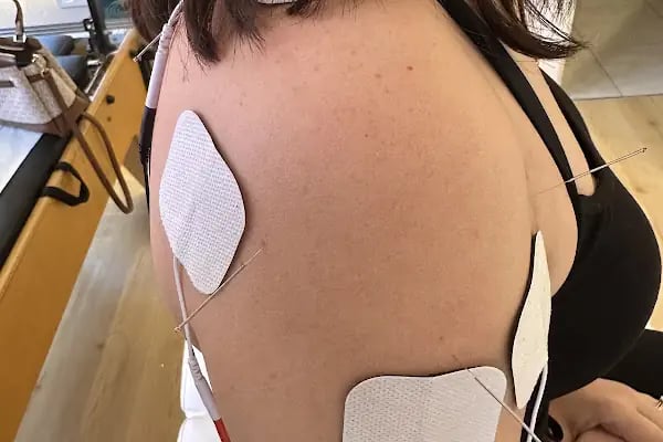 Fizyostar Pilates- Fizik Tedavi ve Sağlıklı Yaşam Merkezi - Resim 14