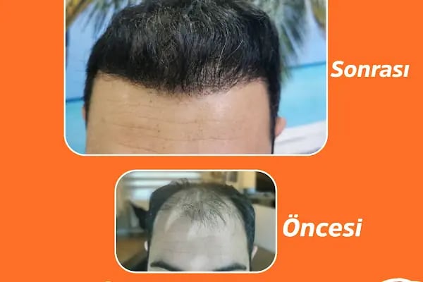 Dr Hair Clinic Saç Ekim merkezi - Resim 4