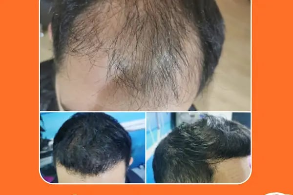 Dr Hair Clinic Saç Ekim merkezi - Resim 5