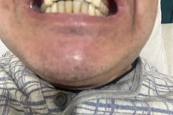 Balgat Ağız ve Diş Sağlığı Merkezi - Resim 17
