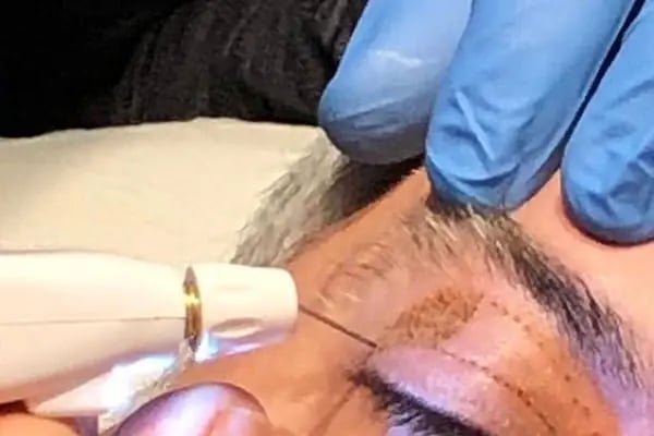 Ayzone Klinik, Aliağa Ozon Tedavi Merkezi - Resim 16