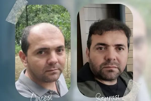 Mk Trabzon Sac Ekim Merkezi - Resim 6