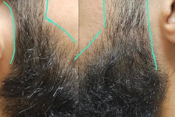 Murat Çakır Erkek Perma | Erkek Mikro Kaynak | Saç Tasarım, Kesim | Keratin - Resim 20