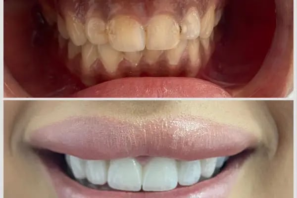 Natural Dent Ağız ve Diş Sağlığı Polikliniği Gaziantep - Resim 12