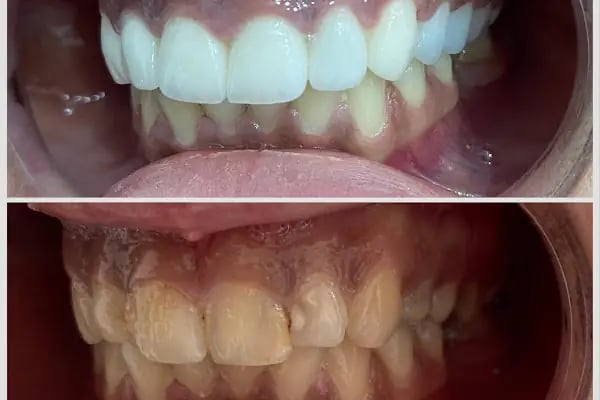 Natural Dent Ağız ve Diş Sağlığı Polikliniği Gaziantep - Resim 14