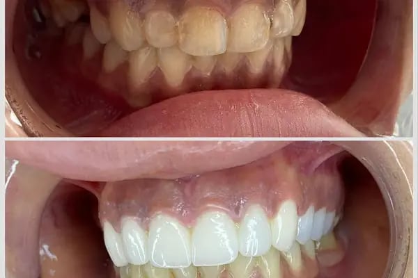 Natural Dent Ağız ve Diş Sağlığı Polikliniği Gaziantep - Resim 11