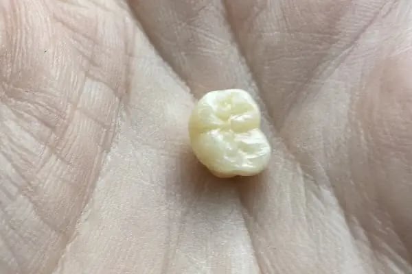 ISMAN Dental Clinic Alanya - İŞMAN Diş Polikliniği - Resim 19