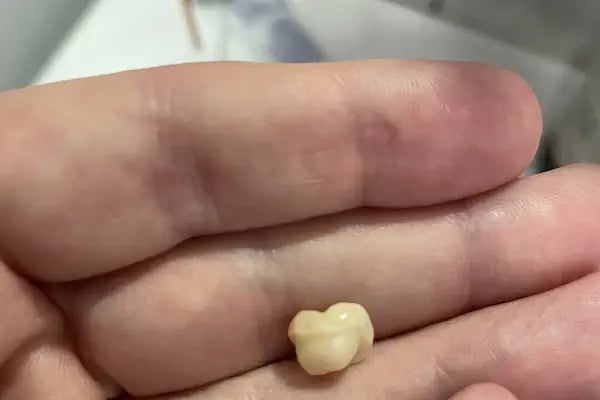 ISMAN Dental Clinic Alanya - İŞMAN Diş Polikliniği - Resim 11