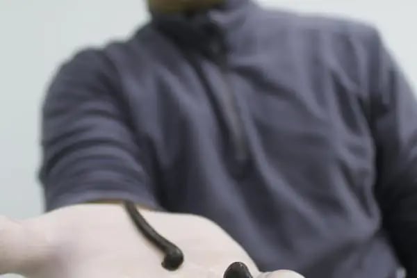 Terapi Masaj Merkezi Hacamat Tedavisi Sülük Tedavisi Fıtık Tedavisi Medikal Masaj Bioenerji Masajı Fast Tedavisi - Resim 19