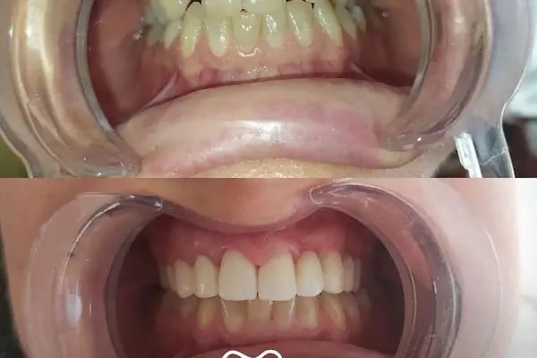 Apex Ağız Ve Diş Sağlığı Polikliniği - Resim 13