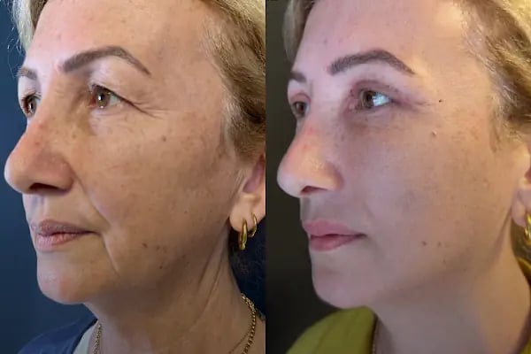 AESTHEAL CLİNİC - Resim 15